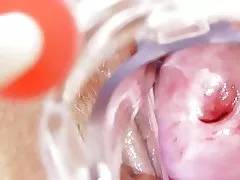 Nurse tħammeġ iġib waħedha